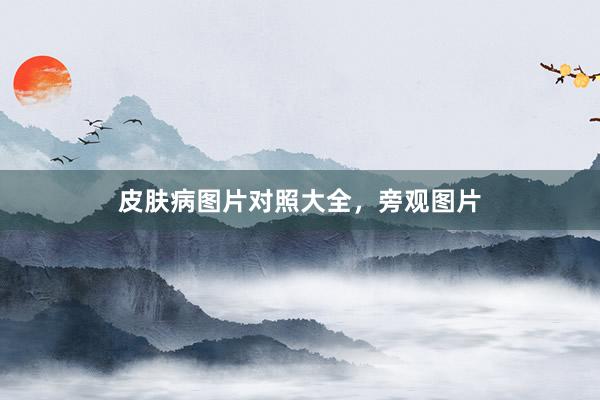 皮肤病图片对照大全，旁观图片